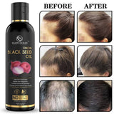Ocean Onion Black Seed Oil For Hair Fall Control, Hair Growth and Hair Regrowth-Control Dandruff - Pack Of 1